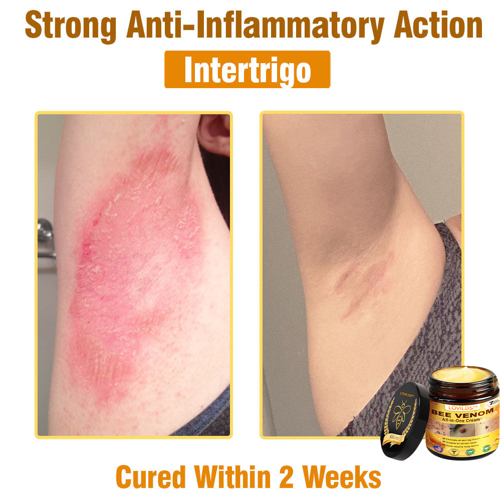 LOVILDS™ Bee Venom Cream – 🌸 Anti-Aging, Hydrating & Skin Repair